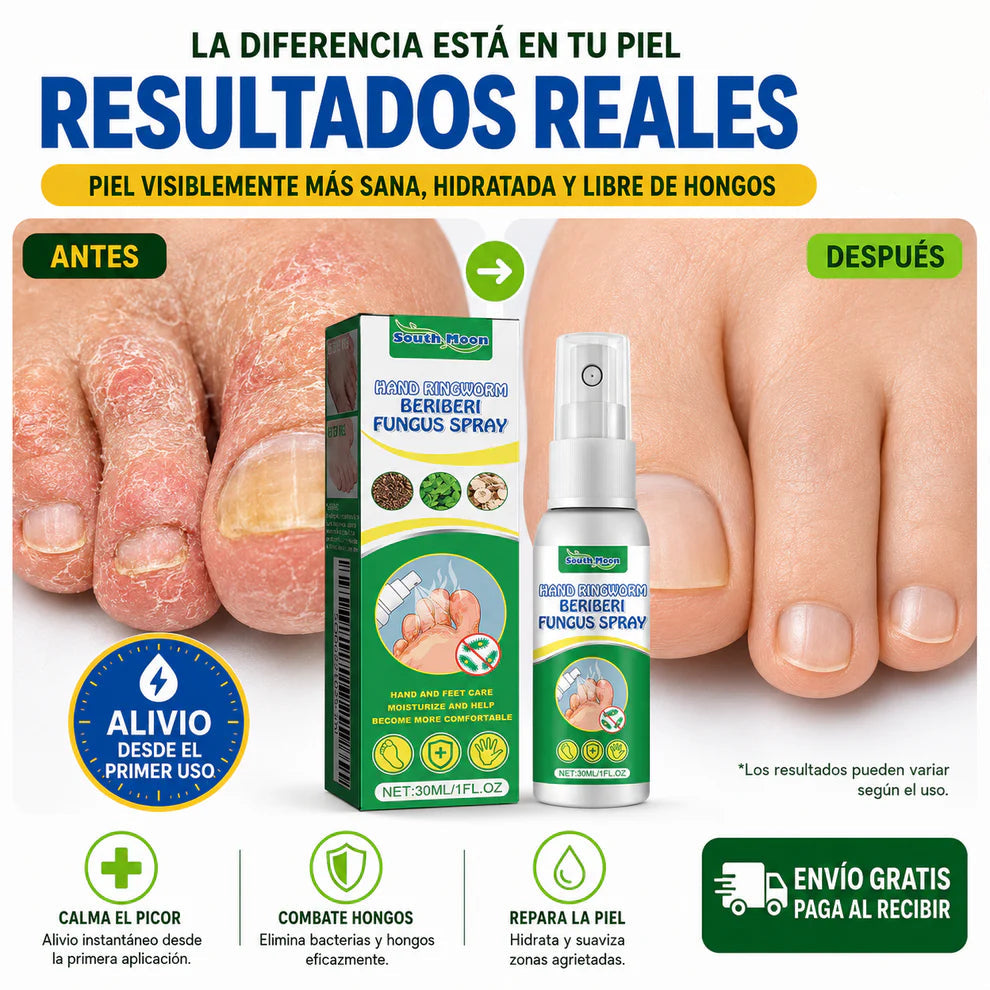 BERIBERI FUNGUS SPRAY® ANTI HONGO ANTI PICAZON