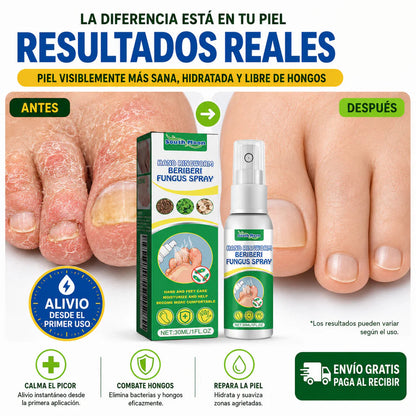 BERIBERI FUNGUS SPRAY® ANTI HONGO ANTI PICAZON